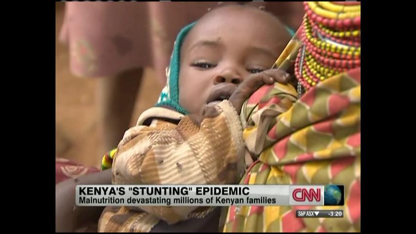 케냐 어린이 영양실조로 성장 부진