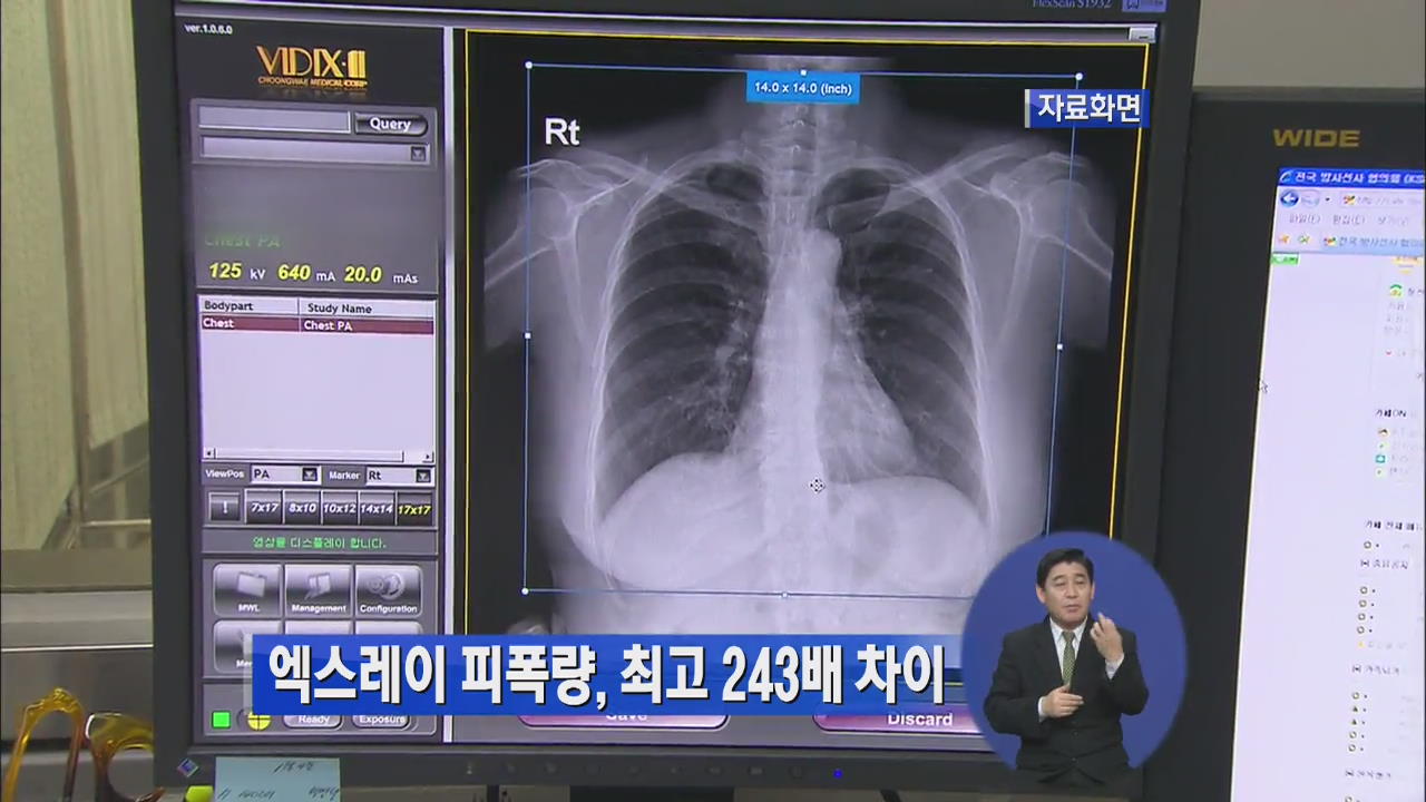 엑스레이 피폭량, 최고 243배 차이