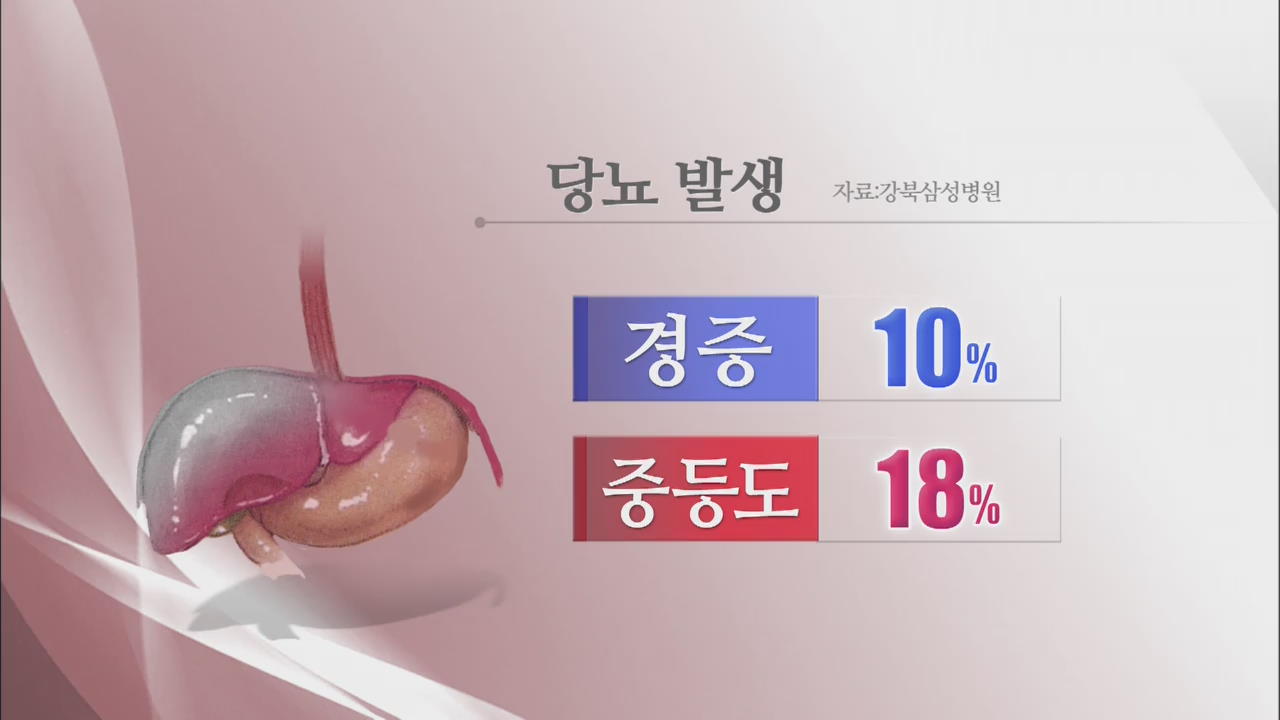 “지방간 환자, 당뇨 발생 위험 70% 높아”