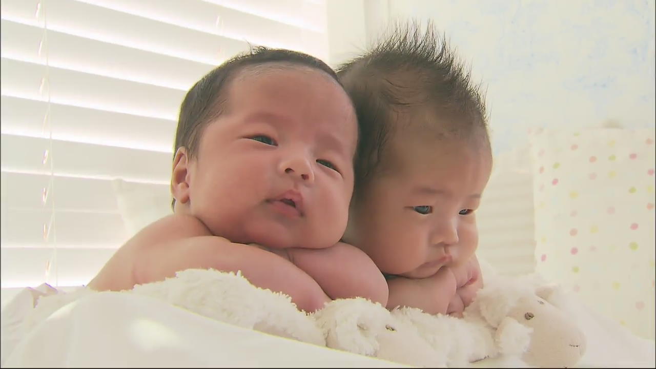 쌍둥이 출산 급증…기쁨 두 배, 부담 서너 배