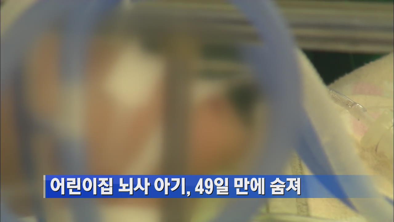 어린이집 뇌사 아기, 49일 만에 숨져