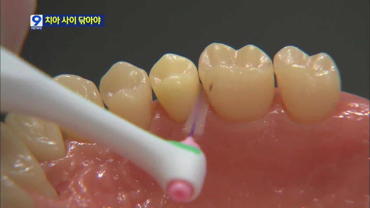 [앵커&리포트] ‘잇몸병 예방’ 올바른 칫솔질 방법