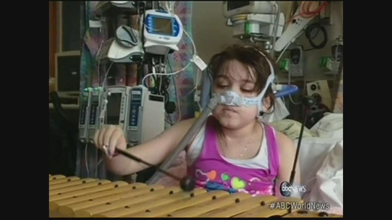 성인 폐 이식 받은 10살 소녀