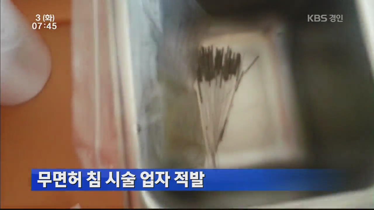 무면허 침 시술 업자 적발