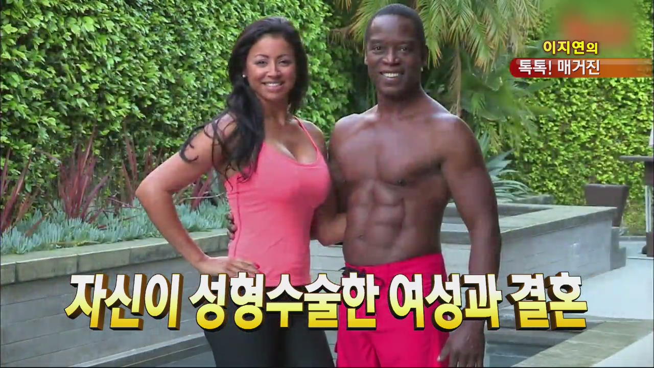 [톡톡! 매거진] 자신이 성형수술한 여성과 결혼 外