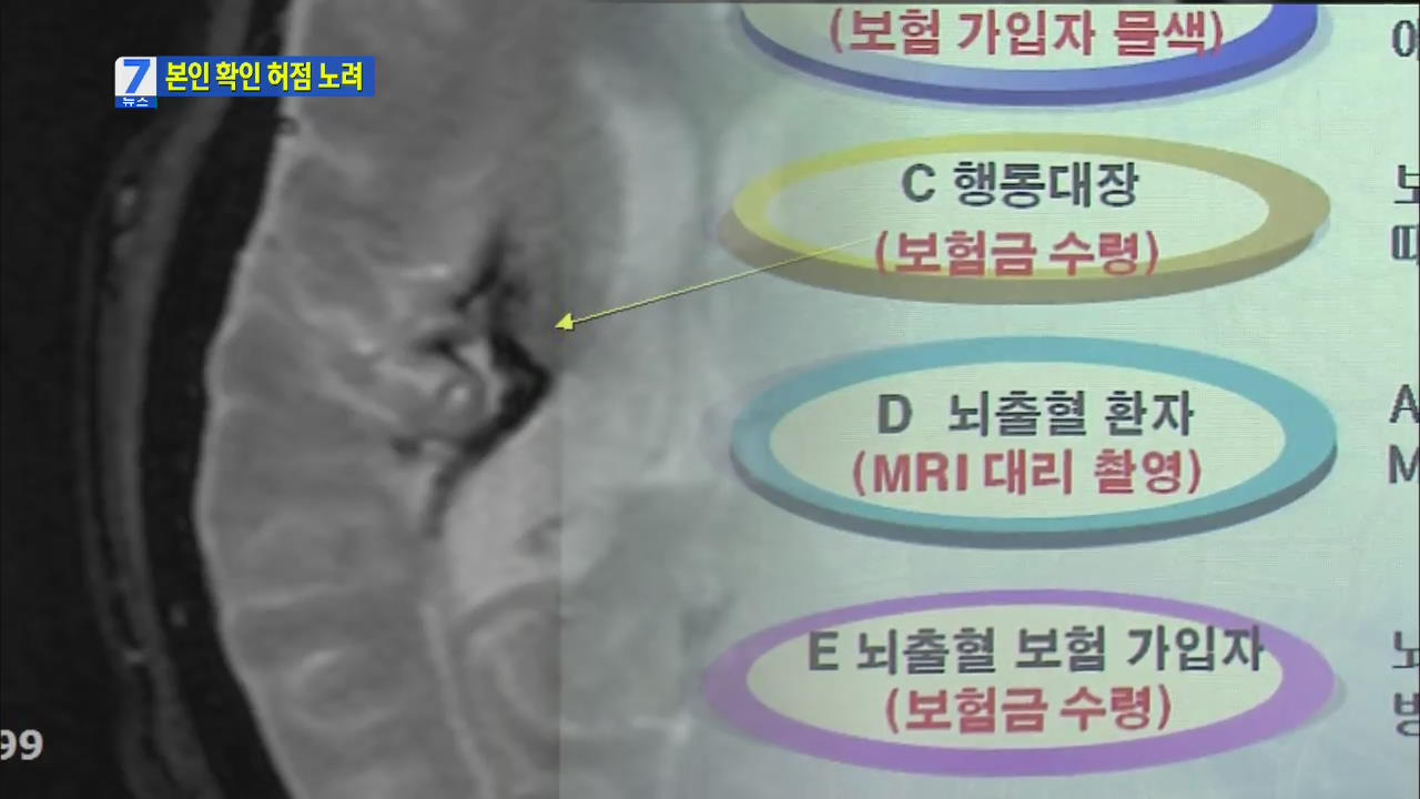 다른 환자의 MRI 사진 이용해 억대 보험사기