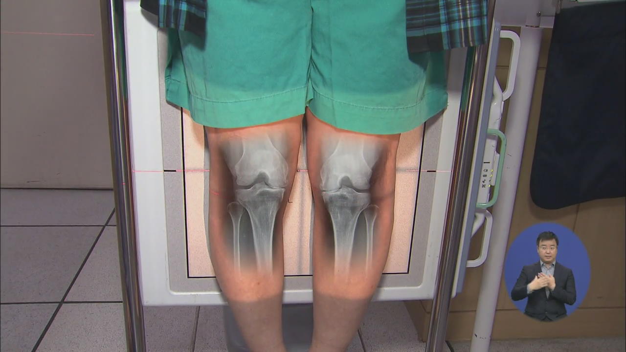 무릎 관절염, 허벅지 근력 강화로 극복
