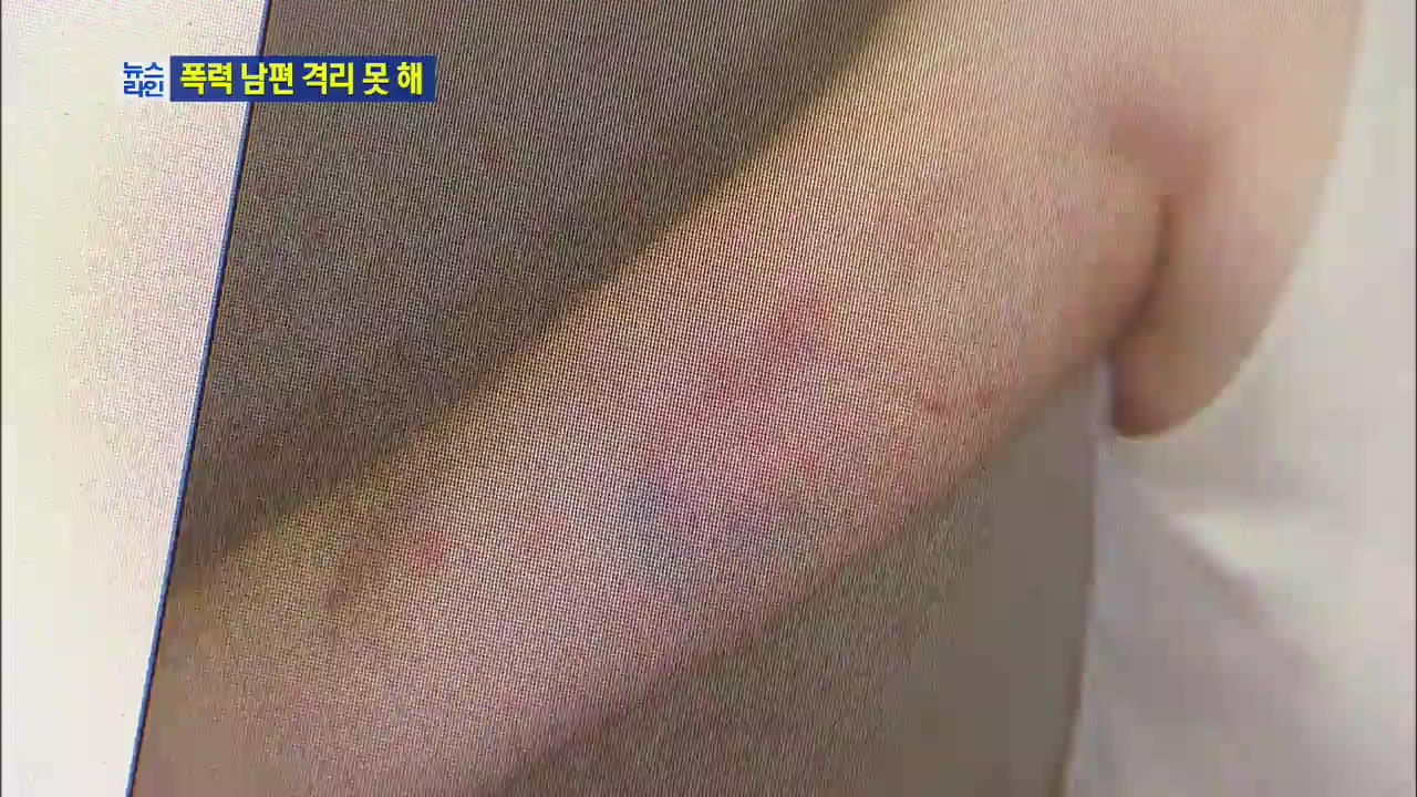 감호 위탁 폭력 남편 격리 못 해