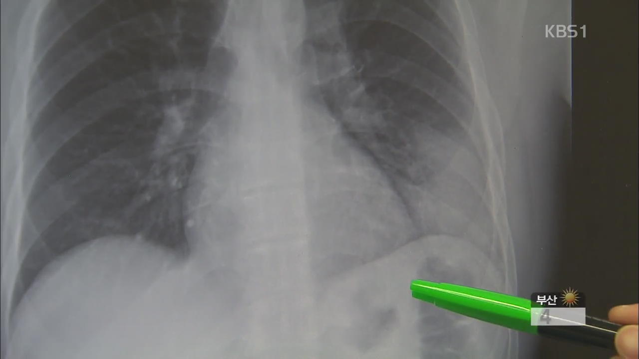 미세먼지 여파…호흡기질환 급증