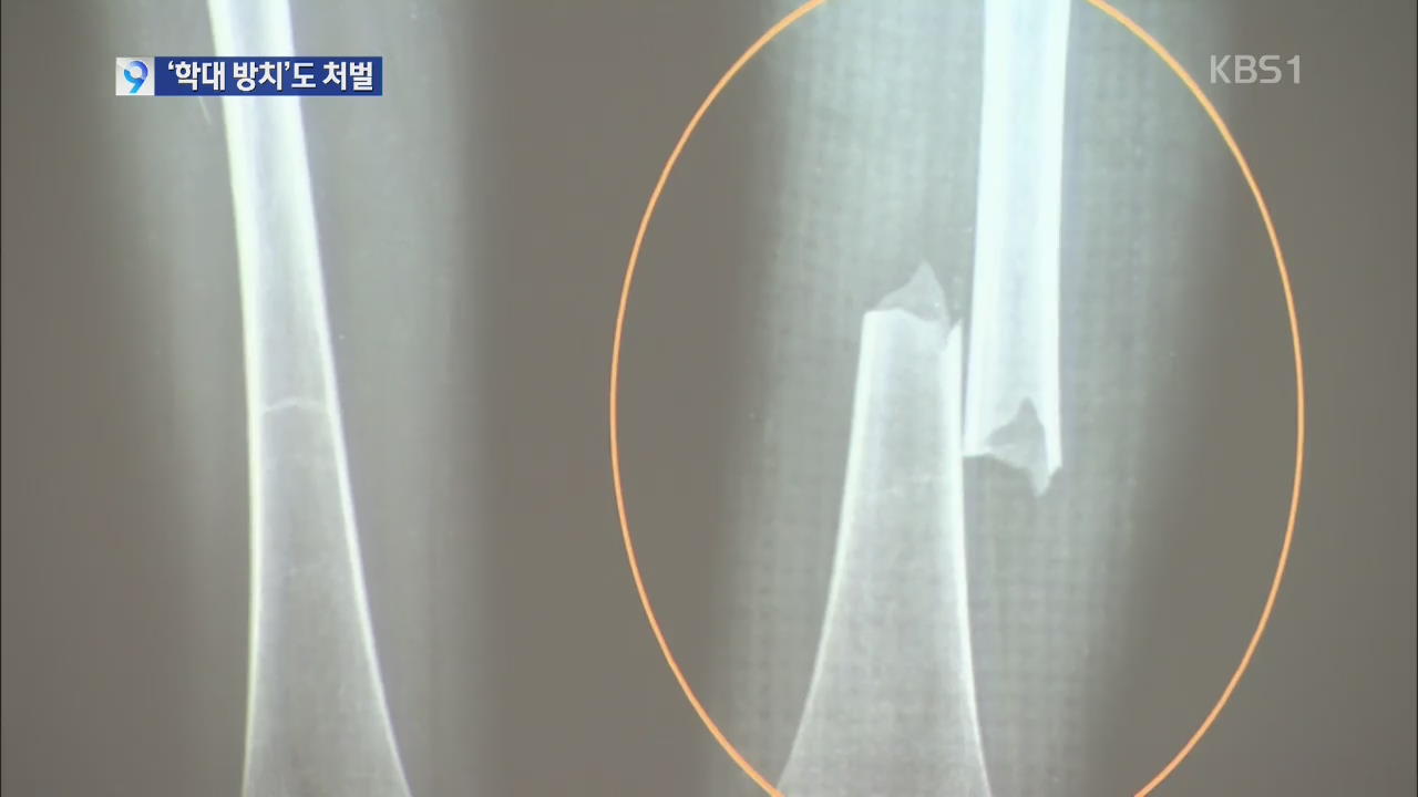 경찰, 새 엄마에게 맞아 숨진 딸 아버지도 형사처벌