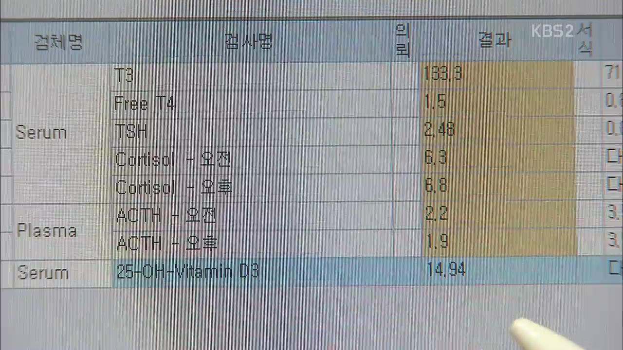 겨울철 비타민D 부족…빈혈 위험 높아