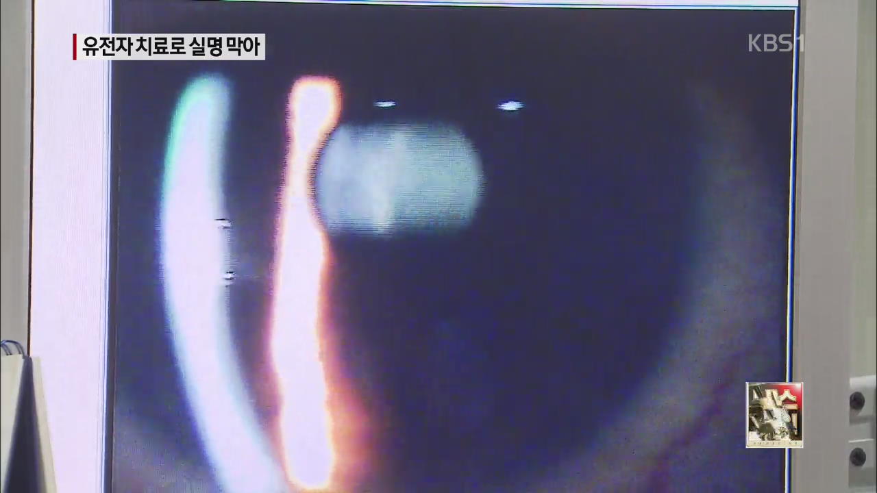 치료 유전자 넣어 망막 재생