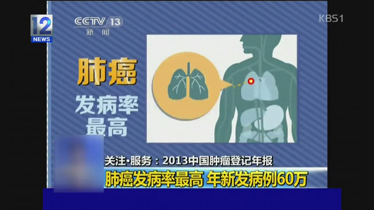 중국인, 폐암 가장 많이 걸리고 여성은 유방암 많아