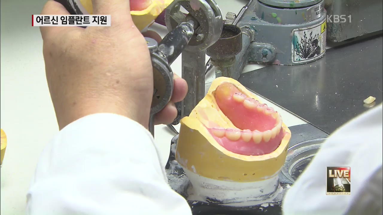 만 75살 이상 임플란트 50% 보험 지원