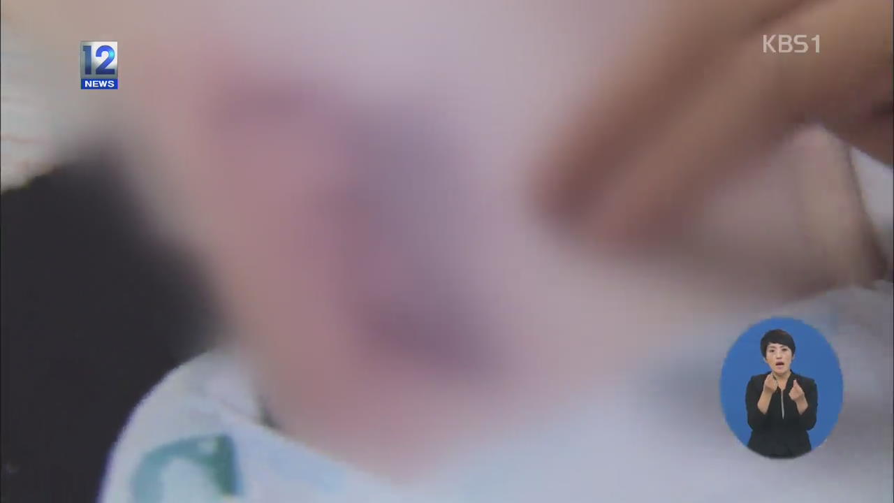 윤일병 폭행 현장에 목격자 11명 있었지만…