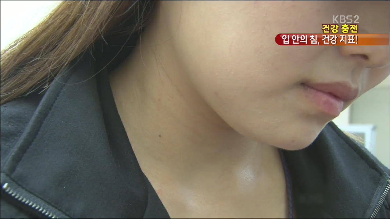 [건강충전] 소화 돕고 세균 막고…건강 지표, 입 속의 ‘침’