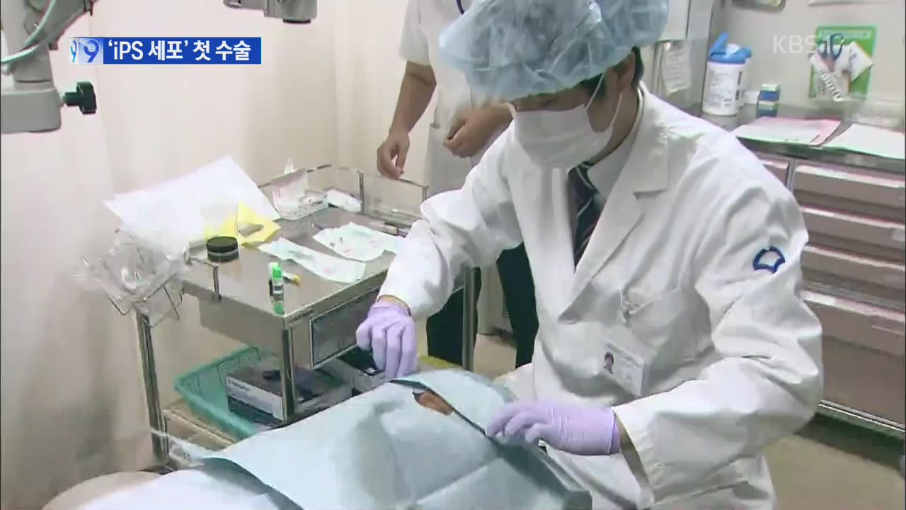 일, 세계 첫 ‘iPS 세포’ 이식수술…난치병 치료 활용