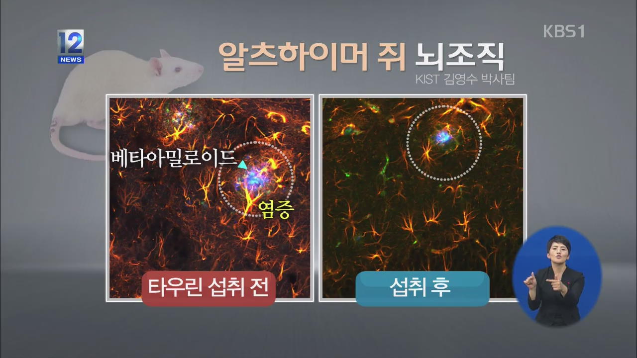 “타우린, 알츠하이머 병 치료에 효과 있다”