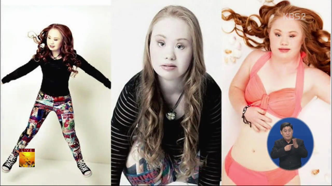 [글로벌24 소식] 다운증후군 소녀 “패션모델 됐어요”