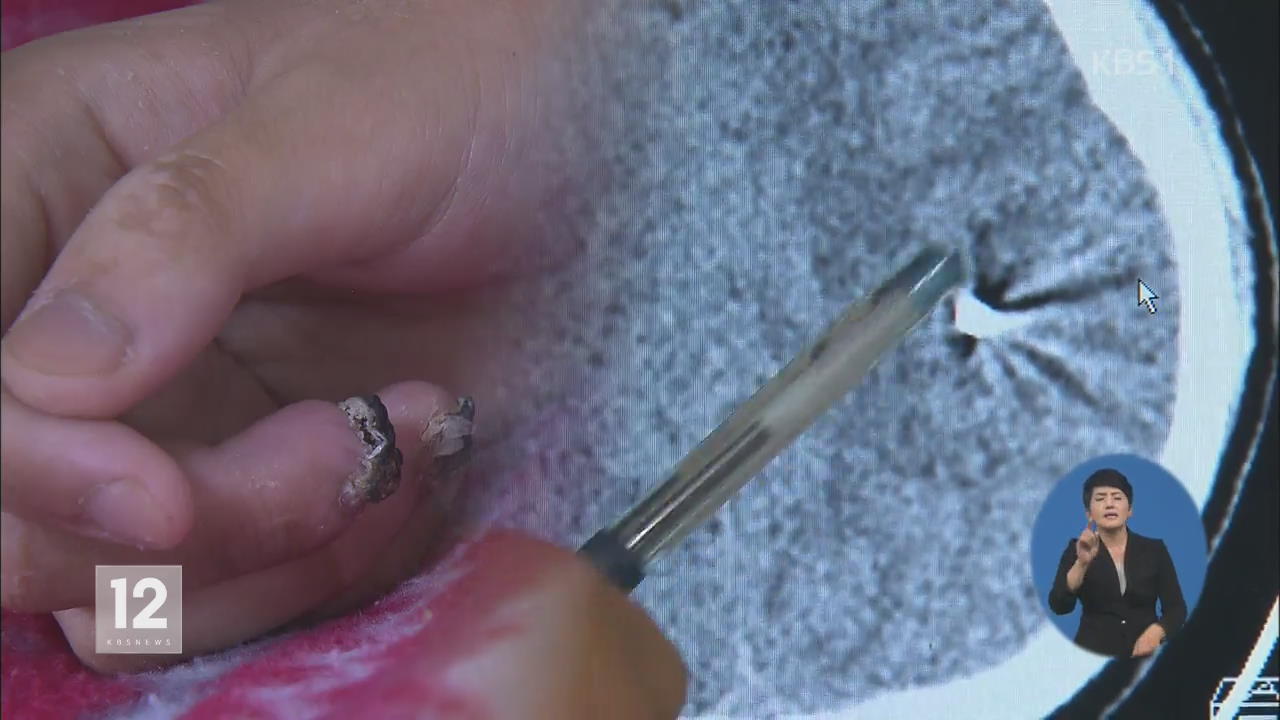 가혹행위로 자살 시도한 이병, ‘군용물 손괴죄’ 입건?