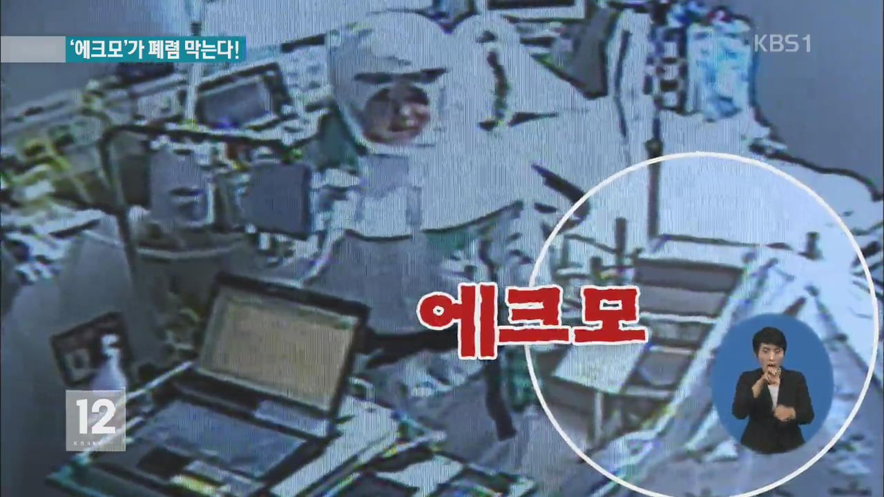 메르스로 망가진 폐…‘에크모’ 인공심폐기로 치료