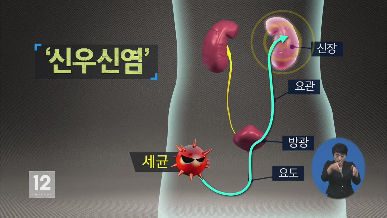 ‘허리 통증·고열’ 40~50대 여성 ‘급성 신우신염’ 주의