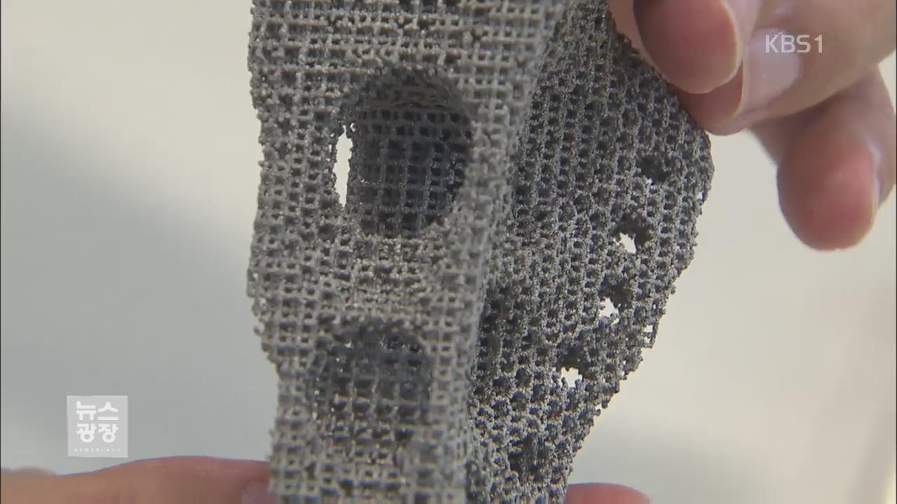 국내서 3D 프린팅 기술로 ‘맞춤형 골반뼈’ 이식 성공