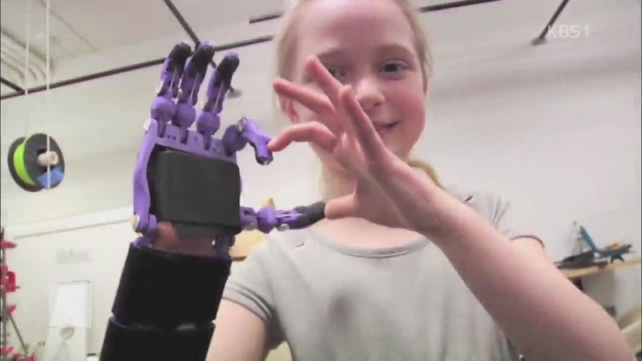 [지금 세계는] 3D 프린팅 ‘인공손’…장애 어린이에 희망