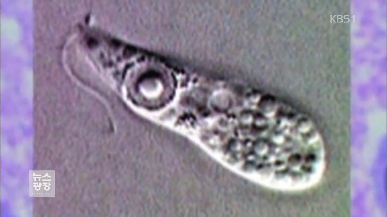 미 ‘뇌 먹는 아메바’ 공포 확산…10대 또 사망