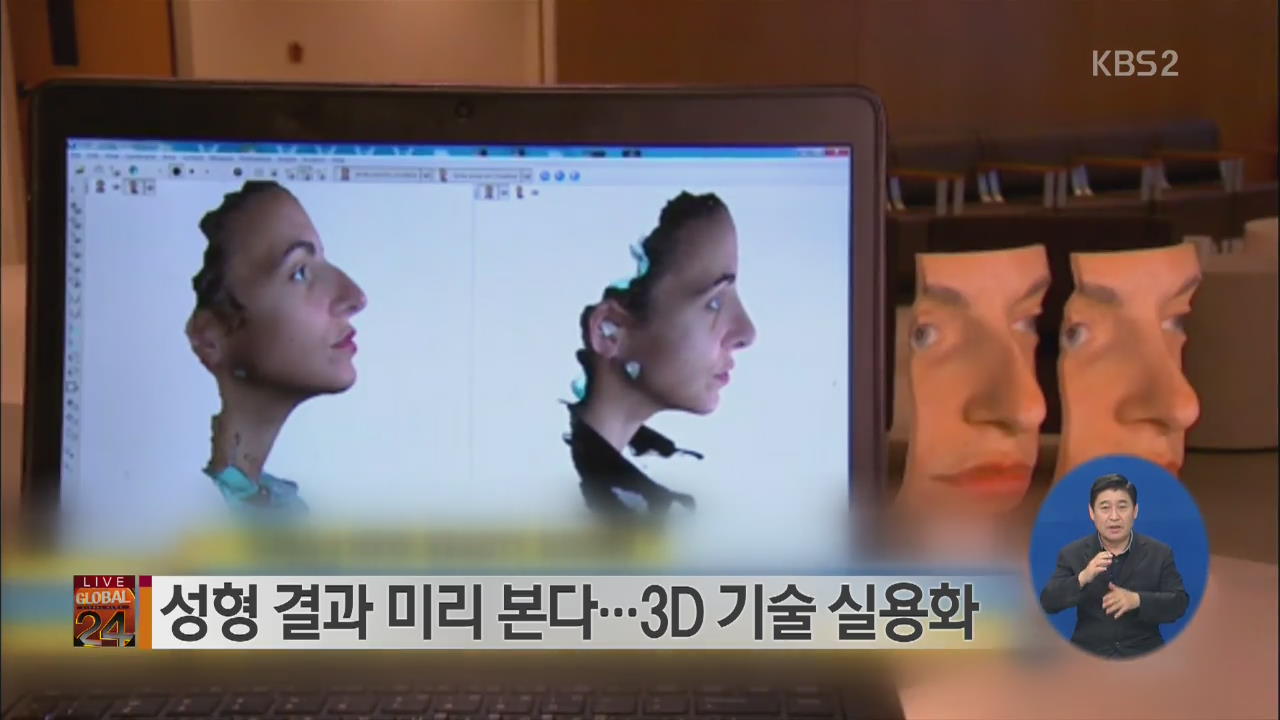 [글로벌24 브리핑] 성형 결과 미리 본다…3D 기술 실용화