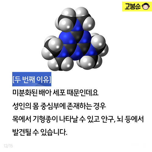 20대 여성의 뱃속에…이런 일이