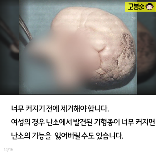 20대 여성의 뱃속에…이런 일이