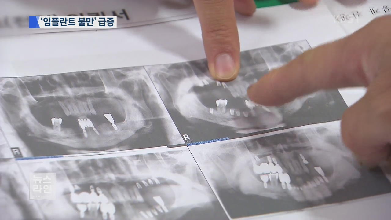 임플란트 과잉 시술…불만 급증