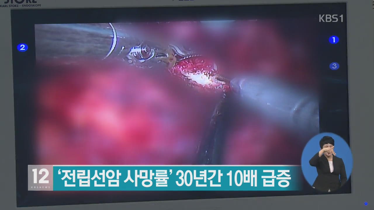 ‘전립선암 사망률’ 30년간 10배 급증