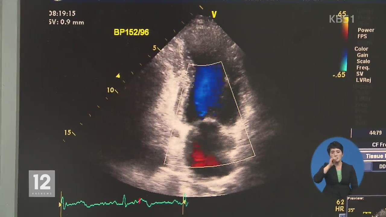 “고장난 심장 ‘심부전’ 사망 10년새 3배 늘어”