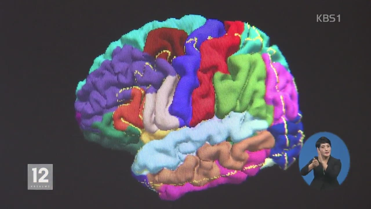 진화하는 인공지능…‘치매 뇌 지도’ 만든다