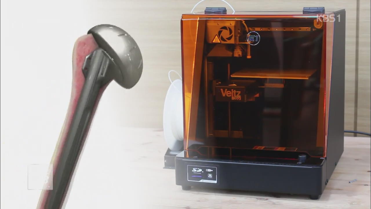 ‘인공관절에서 치아까지’ 3D 프린터 의료 혁명