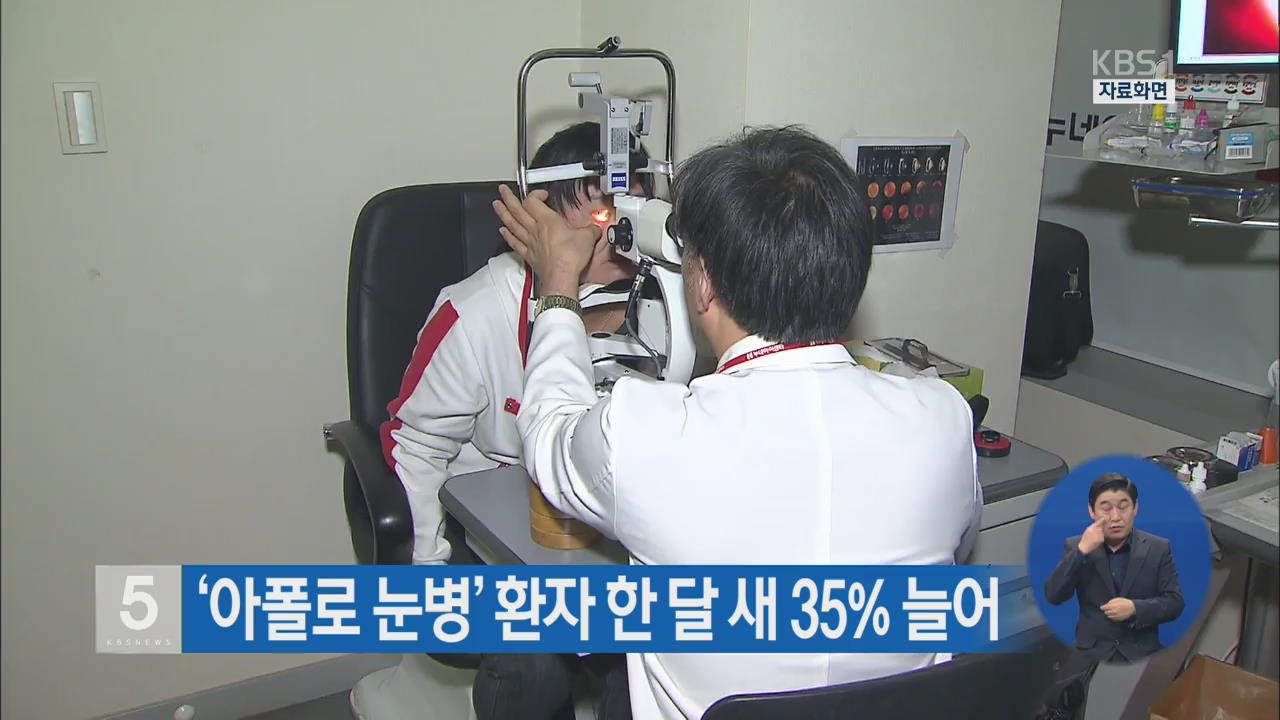 ‘아폴로 눈병’ 환자 한 달 새 35% 늘어