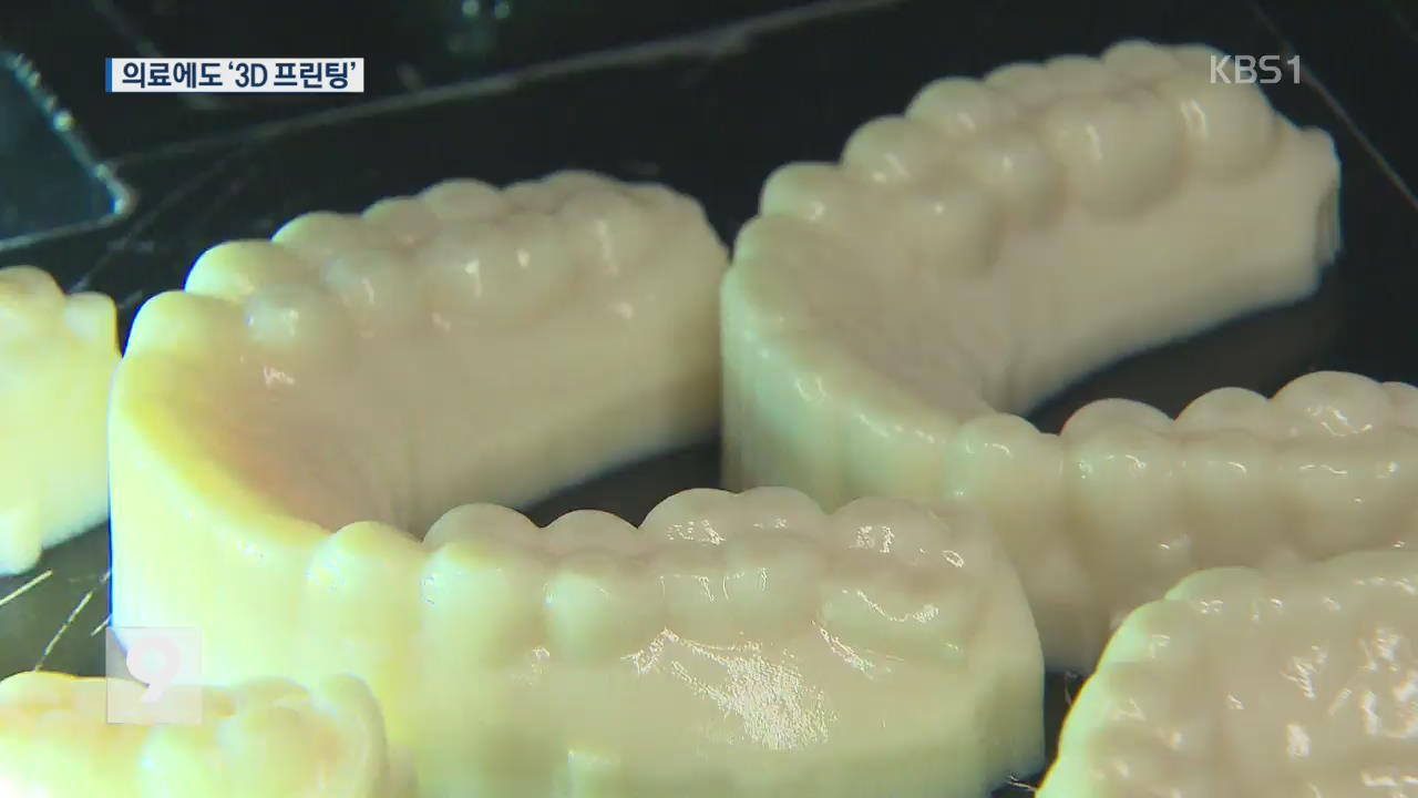 [앵커&리포트] 치아교정·인공뼈까지…진화하는 3D 프린터