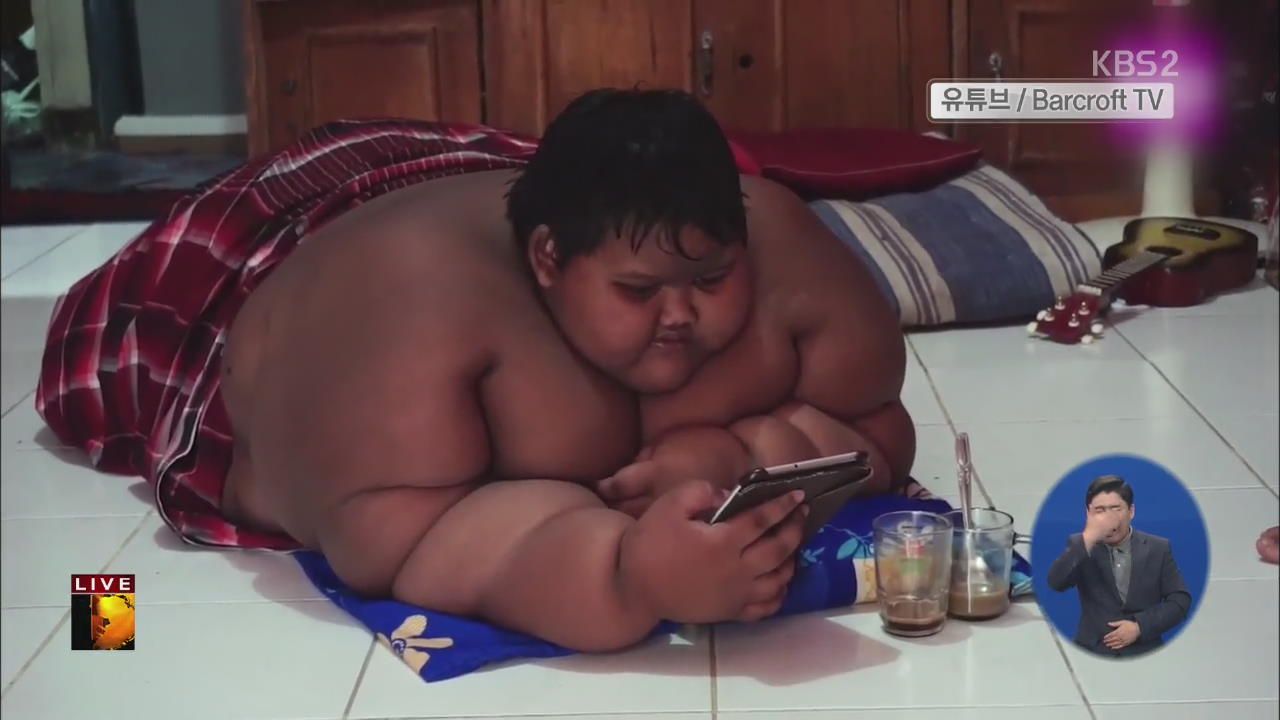 [글로벌24 브리핑] 10살 몸무게 192kg…다이어트에 돌입한 이유