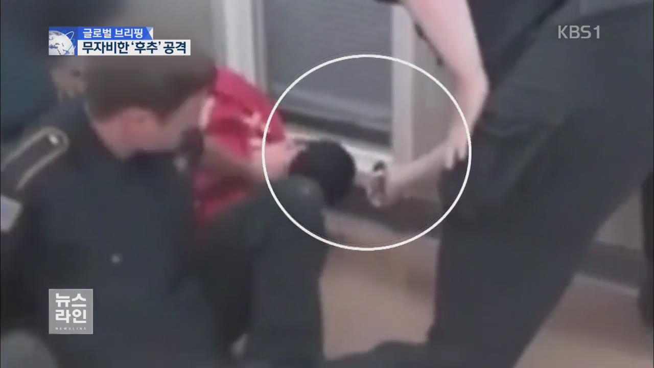 [글로벌 브리핑] 숨 쉬기 힘든 사람에게 ‘후추 스프레이’ 공격