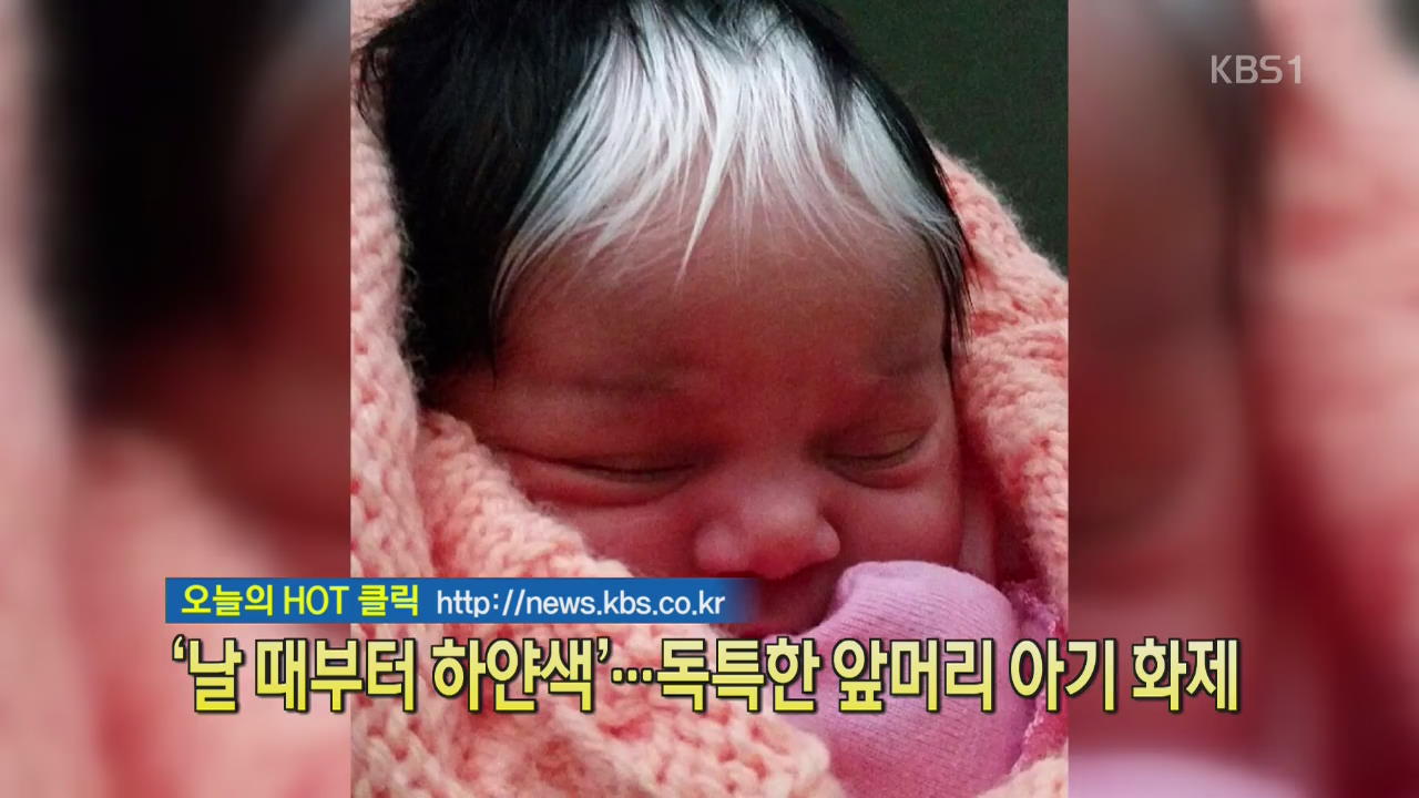 [디지털 광장] ‘날 때부터 하얀색’…독특한 앞머리 아기 화제