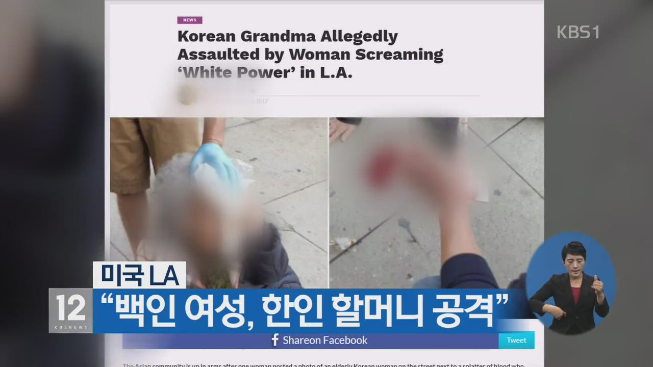 “美 LA서 20대 백인 여성이 한인 할머니 공격”