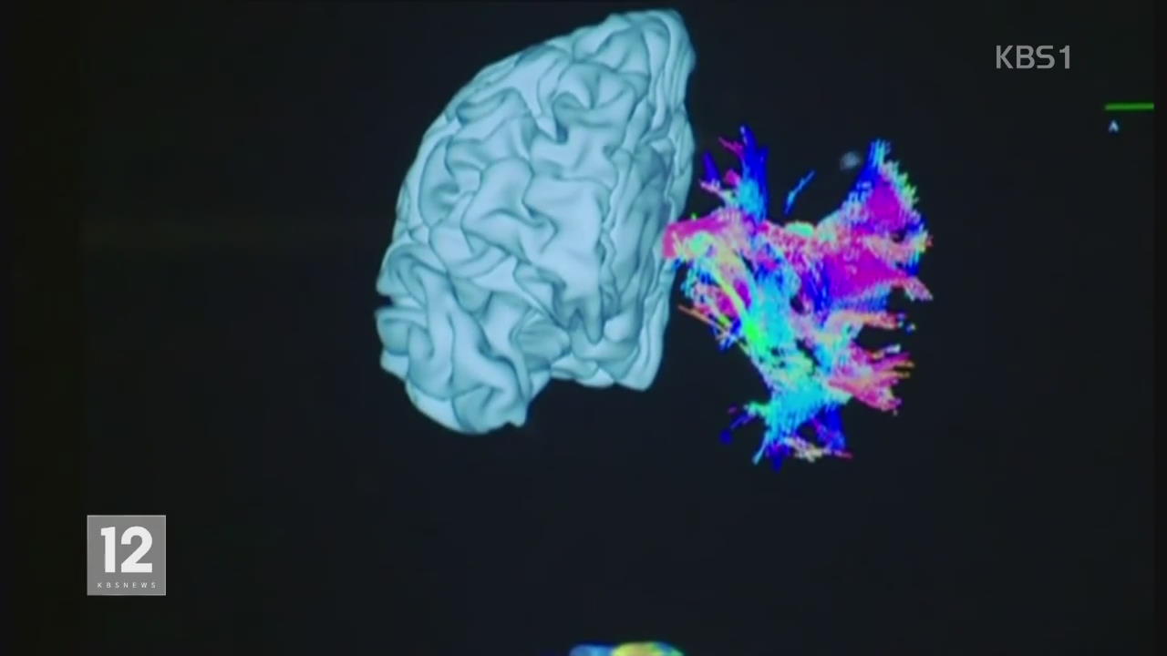 ‘뇌 조직 은행’ 연구진, 뇌 기증 활성화 촉구