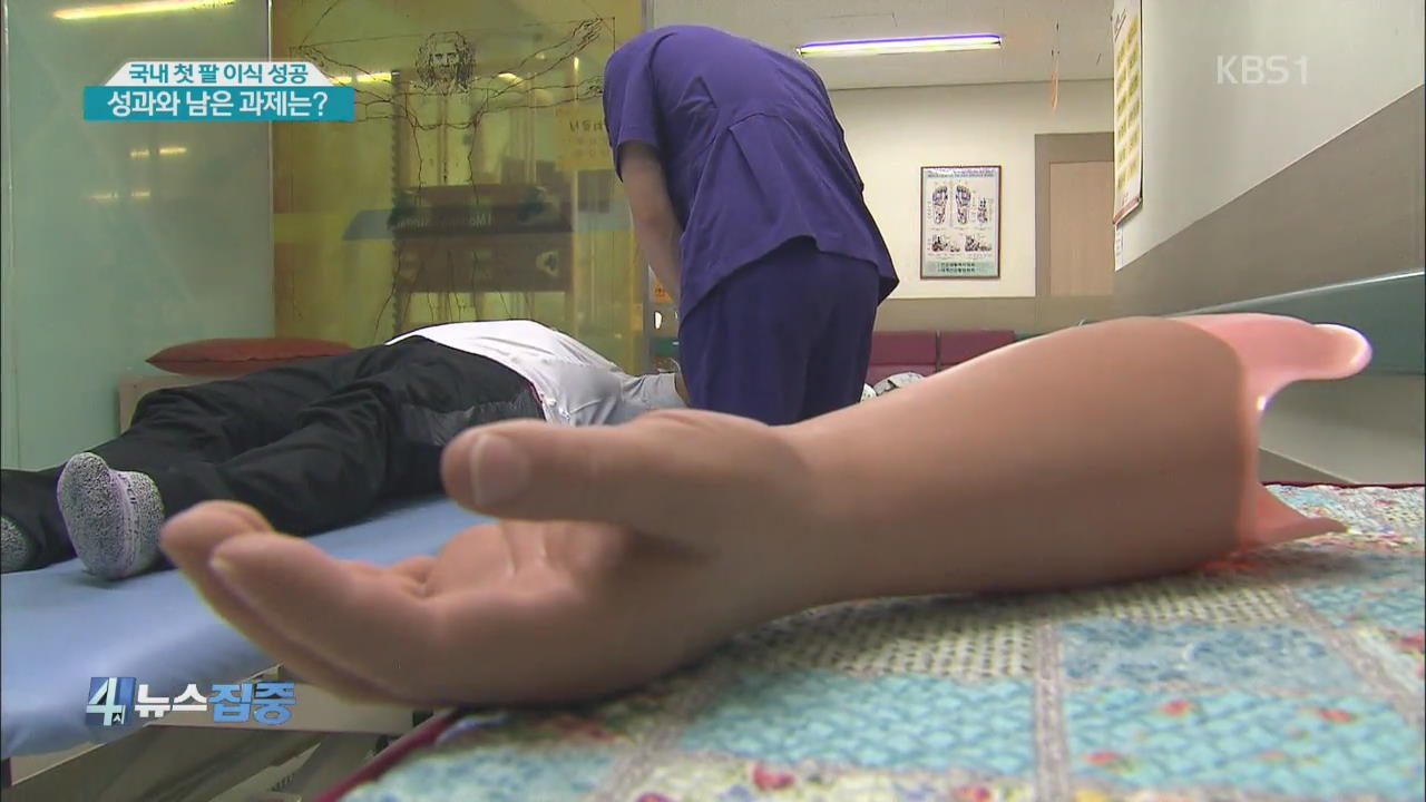 국내 첫 팔 이식 성공…성과와 남은 과제는?