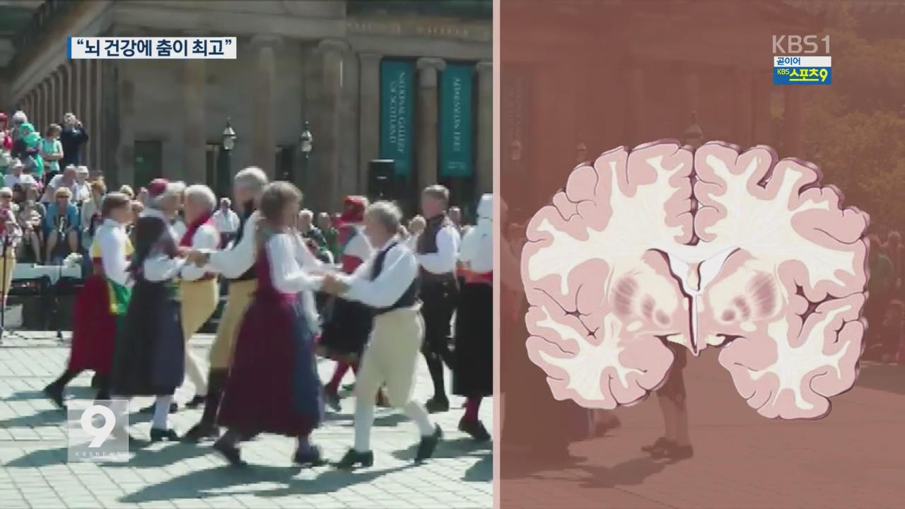 “춤, 뇌 건강 특효약…뇌 기능 개선 뚜렷”