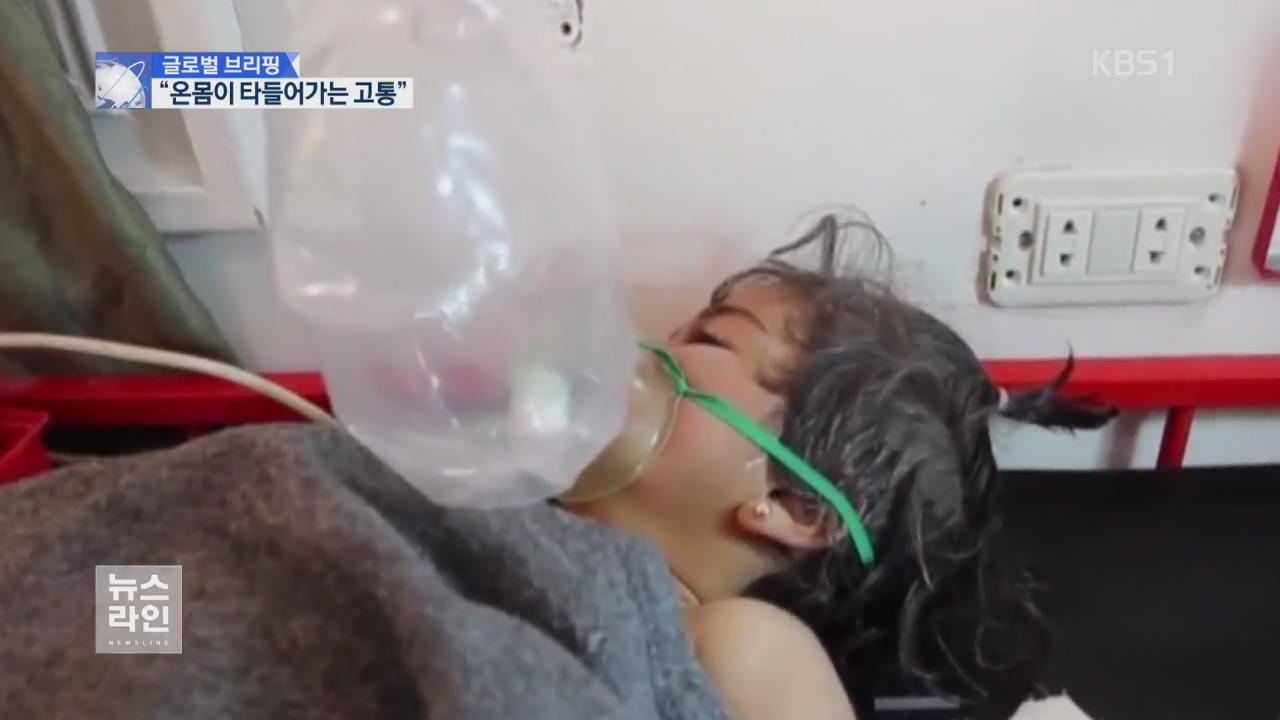 [글로벌 브리핑] “몸이 타들어가는 고통”…“사린가스 노출”