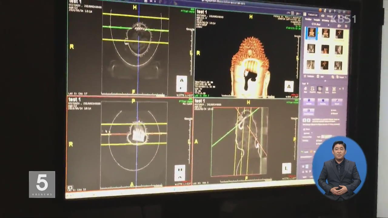 병원 CT로 찍은 불상…‘고려 불경’ 발견