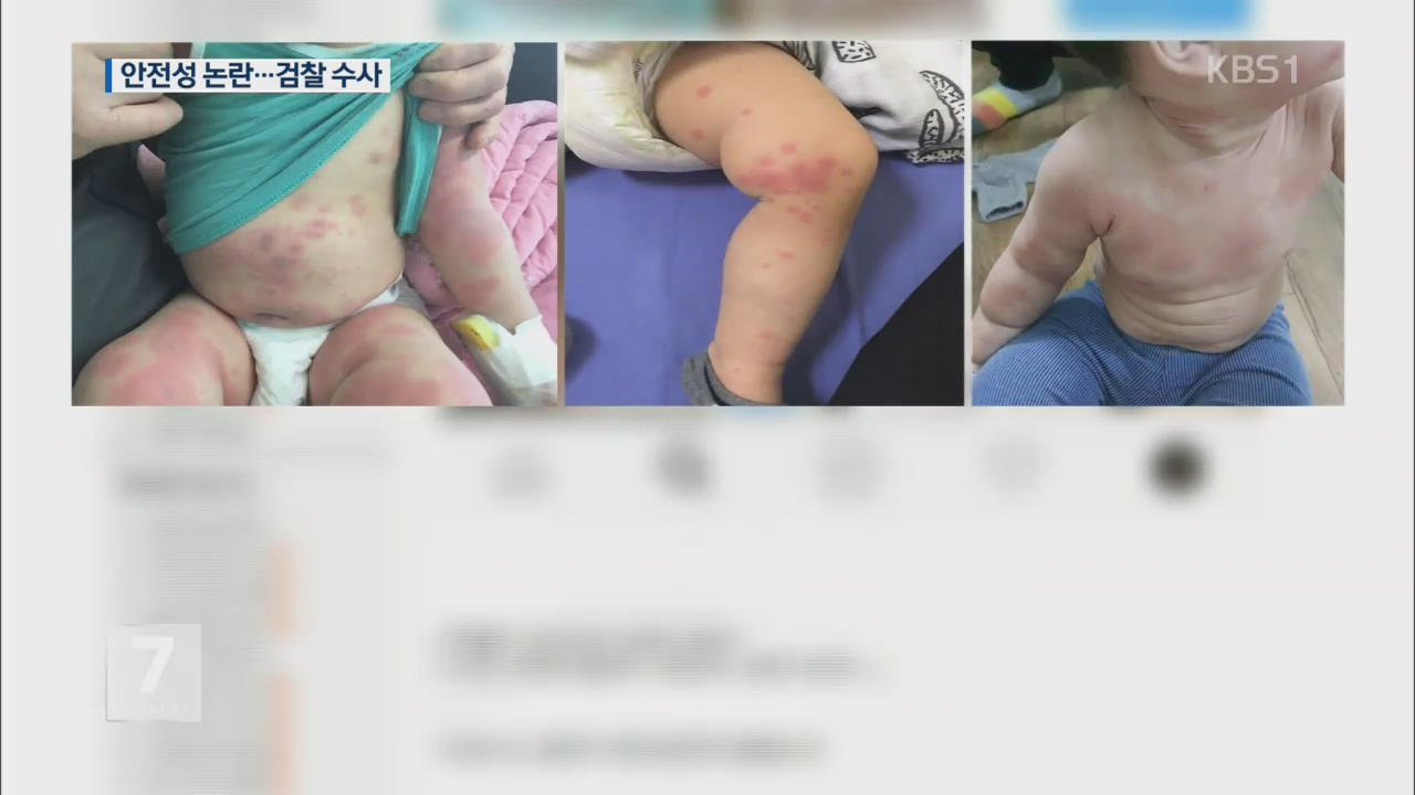 ‘호흡기·피부질환’ 유아용품 논란…수사 착수