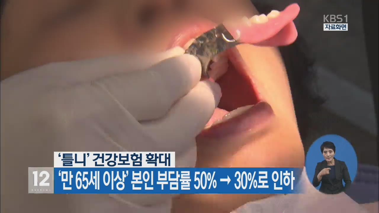 ‘틀니’ 건강보험 확대 ‘만 65세 이상’ 본인 부담률 50%→30%로 인하
